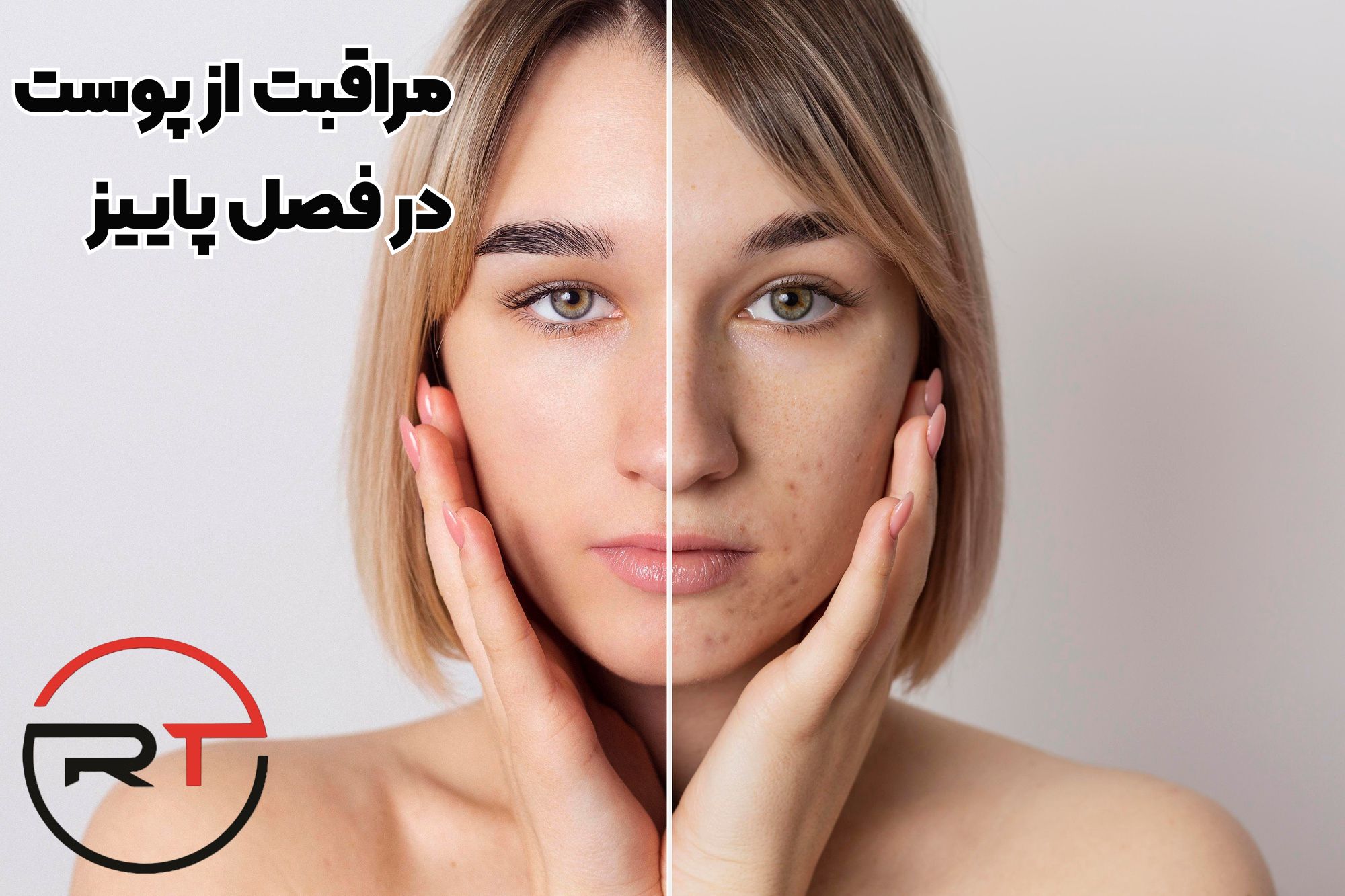 مراقبت از پوست خشک