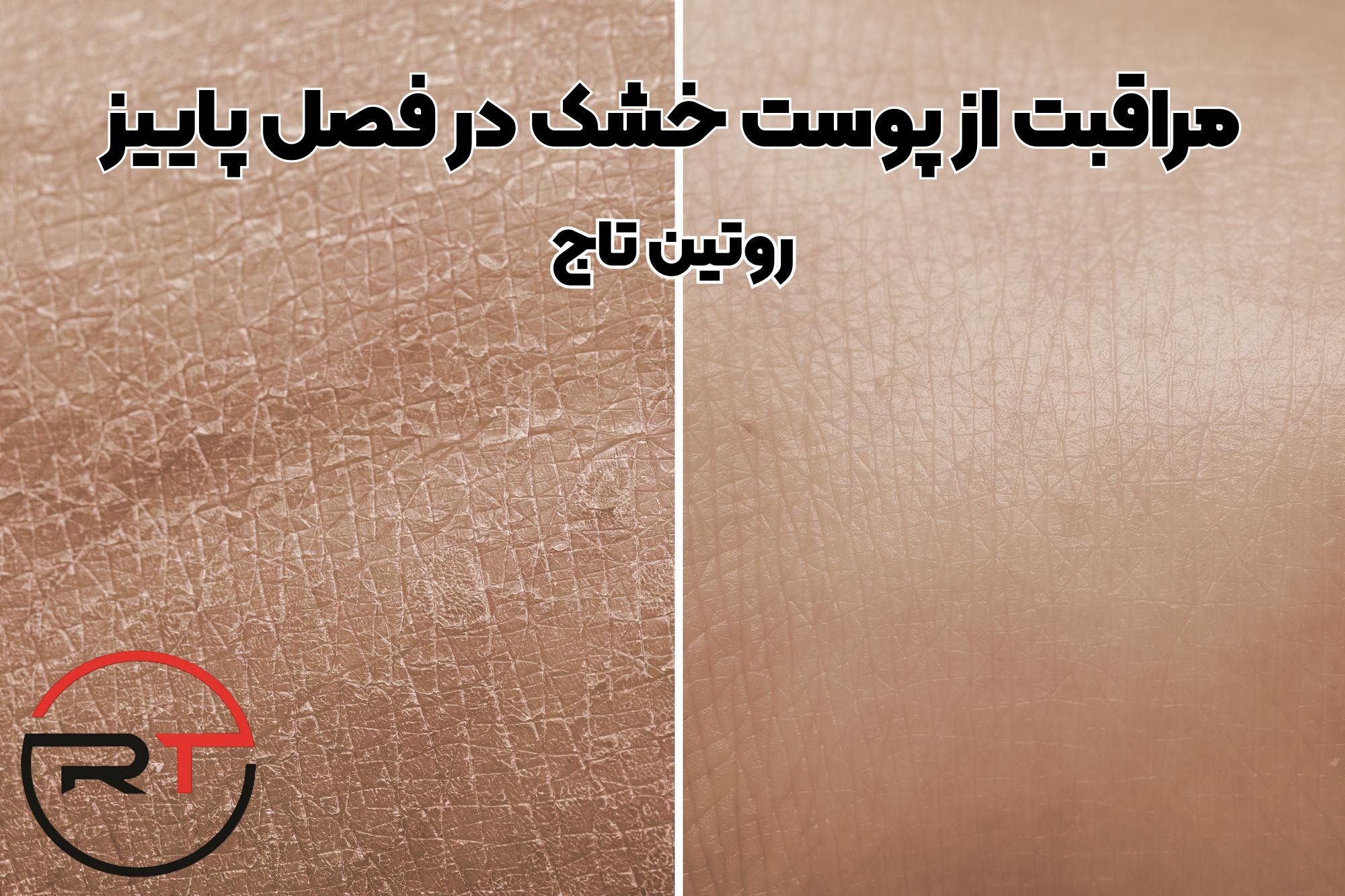 روتین پوست خشک